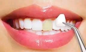 Cosmetic Dental Care